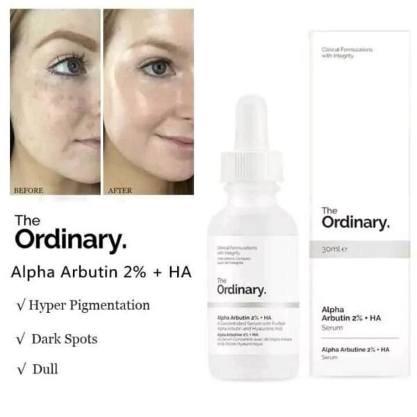The Ordinary Alpha Arbutin 2% + HA Serum 30ml