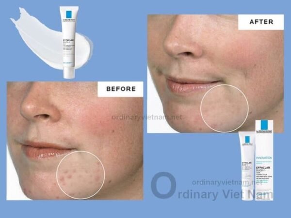 La Roche-Posay Effaclar Duo Plus Treatment Cream Against Skin Imperfections and Acne Blemishes 40