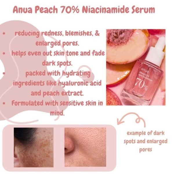 Anua Peach 70% Niacinamide Serum 30ml